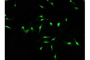 Immunofluorescence staining of U251 cells with ABIN7156399 at 1:100, counter-stained with DAPI. (INTS1 Antikörper  (AA 51-342))