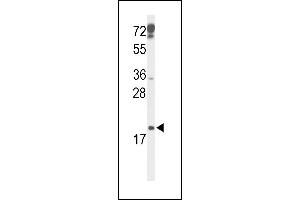 CDKN2D Antikörper  (N-Term)