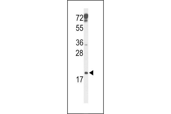 CDKN2D Antikörper  (N-Term)