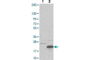 Western blot analysis of Lane 1: Negative control (vector only transfected HEK293T lysate). (CCDC56 Antikörper)