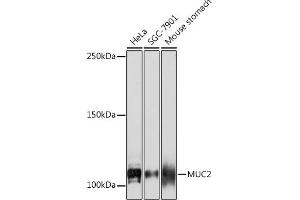 Western blot analysis of extracts of various cell lines, using MUC2 Rabbit mAb (ABIN7268689) at 1:1000 dilution. (MUC2 Antikörper)