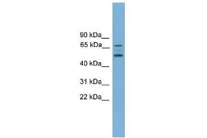 Western Blotting (WB) image for anti-Activin A Receptor, Type IIB (ACVR2B) (Middle Region) antibody (ABIN2782111)