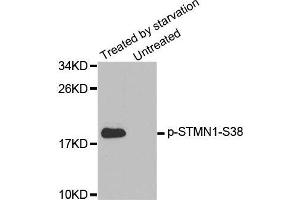 Western blot analysis of extracts from K562 cells, using Phospho-STMN1-S38 antibody. (Stathmin 1 Antikörper  (pSer38))