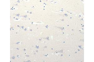 Immunohistochemistry (IHC) image for anti-Solute Carrier Family 18 (Vesicular Monoamine Transporter), Member 2 (SLC18A2) antibody (ABIN1874806) (SLC18A2 Antikörper)