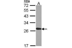 WB Image Sample (30 ug of whole cell lysate) A: H1299 12% SDS PAGE RPL15 antibody antibody diluted at 1:1000 (RPL15 Antikörper)