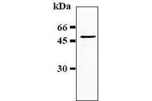 Western Blotting (WB) image for anti-Glial Fibrillary Acidic Protein (GFAP) antibody (ABIN1449150) (GFAP Antikörper)
