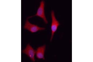 ABIN6261639 and ABIN6276641 staining HeLa cells by IF/ICC. (F11R Antikörper  (C-Term))