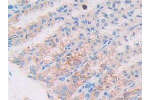 Immunohistochemistry (IHC) image for anti-Uncoupling Protein 2 (Mitochondrial, Proton Carrier) (UCP2) (AA 99-216) antibody (ABIN7435031)