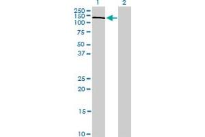 Western Blotting (WB) image for anti-Phosphoinositide 3-kinase Regulatory Subunit 4 (PIK3R4) (AA 1259-1358) antibody (ABIN565477)