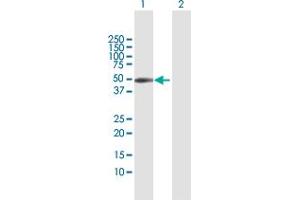 Coxsackie Adenovirus Receptor Antikörper  (AA 1-365)