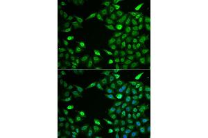Immunofluorescence analysis of A549 cell using INTS6 antibody. (INTS6 Antikörper)