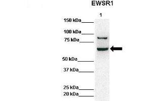Lanes:   Lane 1: 50ug Hela Lysate  Primary Antibody Dilution:   1:1000  Secondary Antibody:   Anti-rabbit-HRP  Secondary Antibody Dilution:   1:10,000  Gene Name:   EWSR1  Submitted by:   Archa Fox, University of Western Australia  EWSR1 is strongly supported by BioGPS gene expression data to be expressed in Human HeLa cells (EWSR1 Antikörper  (Middle Region))