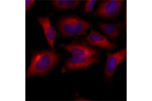 Immunofluorescence of human HeLa cells stained with Hoechst 3342 (Blue) for nucleus staining and BAK1 monoclonal antibody, clone AT8B4  (1 : 500) with Texas Red (Red). (BAK1 Antikörper  (AA 29-187))