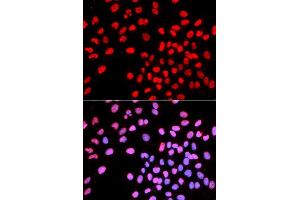 Immunofluorescence analysis of U2OS cell using IKZF1 antibody. (IKZF1 Antikörper  (AA 1-270))
