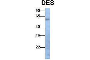 Host:  Rabbit  Target Name:  DES  Sample Type:  Human Fetal Lung  Antibody Dilution:  1. (Desmin Antikörper  (Middle Region))