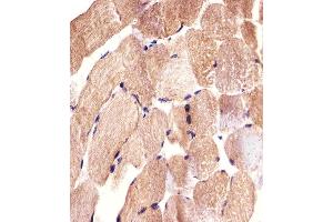 Immunohistochemical analysis of paraffin-embedded H. (CARD6 Antikörper)