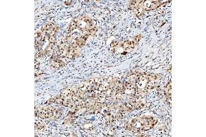 IHC analysis of U1-C/SNRPC using anti-U1-C/SNRPC antibody (ABIN7599016).