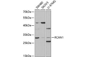 Western blot analysis of extracts of various cell lines, using RC antibody (ABIN6129452, ABIN6146811, ABIN6146812 and ABIN6220955) at 1:1000 dilution. (RCAN1 Antikörper  (AA 60-245))