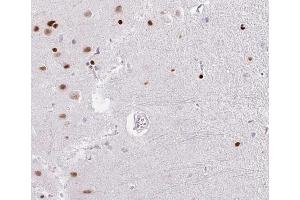 ABIN6266529 at 1/100 staining human brain tissue sections by IHC-P.