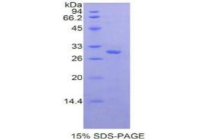 SDS-PAGE analysis of Rat Protein Kinase R Protein. (EIF2AK2 Protein)