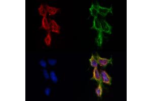 ABIN6262174 and ABIN6269018 staining HepG2 by IF/ICC. (HDAC10 Antikörper  (N-Term))