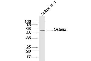 Mouse spinal cord lysates probed with Osterix Polyclonal Antibody, unconjugated  at 1:300 overnight at 4°C followed by a conjugated secondary antibody for 60 minutes at 37°C. (SP7 Antikörper  (AA 331-431))