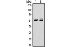 Western blot analysis of Carbonic Anhydrase 9 expression in Hela (A), 293T (B) whole cell lysates. (CA9 Antikörper)