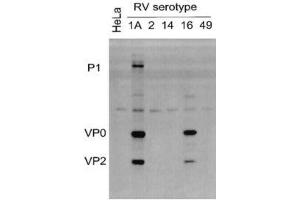Lysates of HeLa cells infected with RV serotypes 1A, 2, 14, 16 or 49 and blotted with ABIN1000236 (Rhinovirus 16 Antikörper)