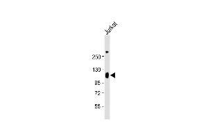 Anti-LP2 Antibody (Center) at 1:2000 dilution + Jurkat whole cell lysate Lysates/proteins at 20 μg per lane. (LAMP2 Antikörper  (AA 196-225))