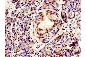Immunohistochemistry of paraffin-embedded human pancreatic tissue using ABIN7147925 at dilution of 1:100 (CPSF6 Antikörper  (AA 186-226))