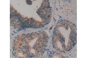 Used in DAB staining on fromalin fixed paraffin- embedded prostate gland tissue (COL6 Antikörper  (AA 1-336))
