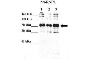 Western Blotting (WB) image for anti-Heterogeneous Nuclear Ribonucleoprotein L (HNRNPL) (N-Term) antibody (ABIN2778777)