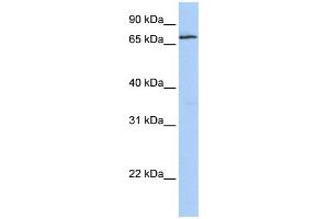 WB Suggested Anti-ZNF548 Antibody Titration:  0. (ZNF548 Antikörper  (N-Term))