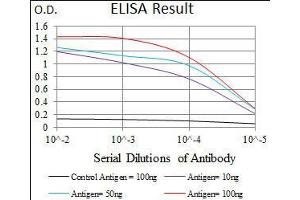 Black line: Control Antigen (100 ng), Purple line: Antigen(10 ng), Blue line: Antigen (50 ng), Red line: Antigen (100 ng), (PCNA Antikörper  (AA 53-196))