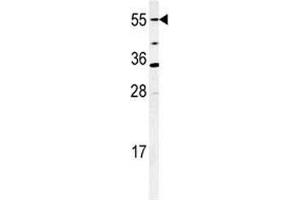 Western blot analysis of CYP26A1 antibody and mouse NIH3T3 cell lysate. (CYP26A1 Antikörper  (AA 467-497))