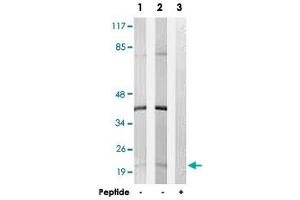 Western blot analysis of extracts from K-562 cells (Lane 1) and Jurkat cells (Lane 2 and lane 3), using C6orf108 polyclonal antibody .
