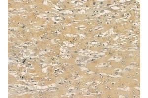 ABIN6265508 and ABIN6273329 at 1/100 staining human normal lung tissue by IHC-P. (TCTN2 Antikörper  (Internal Region))