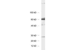 dilution: 1 : 1000, sample: 3T3 fibroblasts (STXBP4 Antikörper)