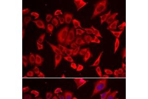 Immunofluorescence analysis of HeLa cells using SLC20A2 Polyclonal Antibody (SLC20A2 Antikörper)