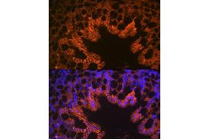 Immunofluorescence analysis of mouse large intestine using LI Cadherin/Cadherin-17 Rabbit mAb (ABIN7268249) at dilution of 1:100 (40x lens). (LI Cadherin Antikörper)
