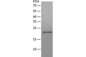 Western Blotting (WB) image for Crystallin, gamma D (CRYGD) (AA 1-174) protein (His tag) (ABIN7122504) (CRYGD Protein (AA 1-174) (His tag))