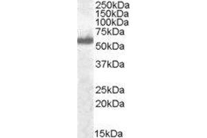 Western Blotting (WB) image for Interferon Regulatory Factor 5 (IRF5) peptide (ABIN369637) (Interferon Regulatory Factor 5 (IRF5) Peptid)