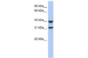 Western Blotting (WB) image for anti-Chromosome 5 Open Reading Frame 35 (C5orf35) antibody (ABIN2459640) (C5orf35 Antikörper)