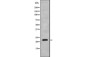 Western blot analysis IFNA8 using K562 whole cell lysates (IFNA8 Antikörper  (Internal Region))
