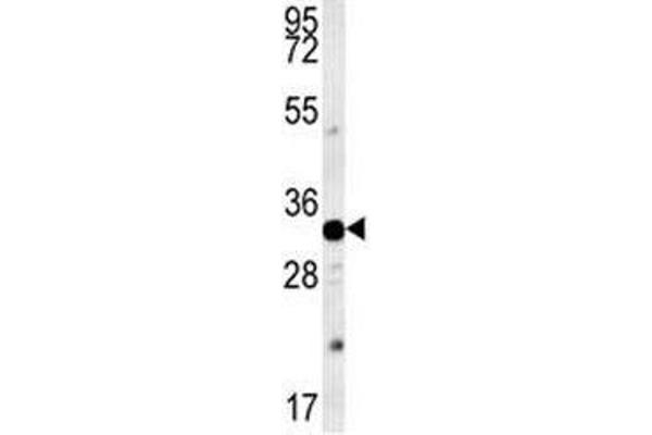 AQP11 Antikörper  (AA 244-271)