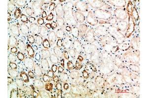 Immunohistochemical analysis of paraffin-embedded human-kidney, antibody was diluted at 1:200 (CTLA4 Antikörper  (AA 41-90))