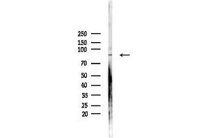 Western blot analysis of lysates from PC12 cells(heat-shock,45 min treatment), using EHHADH Antibody at 1/1000 dilution.