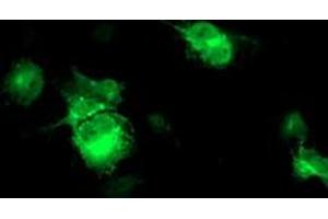Anti-FBXO21 mouse monoclonal antibody (ABIN2455305) immunofluorescent staining of COS7 cells transiently transfected by pCMV6-ENTRY FBXO21 (RC223095).