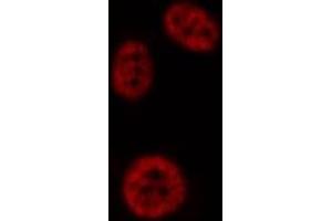 ABIN6276948 staining HepG2? (PAD4 Antikörper  (N-Term))