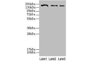 Western blot All lanes: CLTCL1 antibody at 2 μg/mL Lane 1: Jurkat whole cell lysate Lane 2: NIH/3T3 whole cell lysate Lane 3: A431 whole cell lysate Secondary Goat polyclonal to rabbit IgG at 1/10000 dilution Predicted band size: 188, 181 kDa Observed band size: 188 kDa (CLTCL1 Antikörper  (AA 1423-1566))